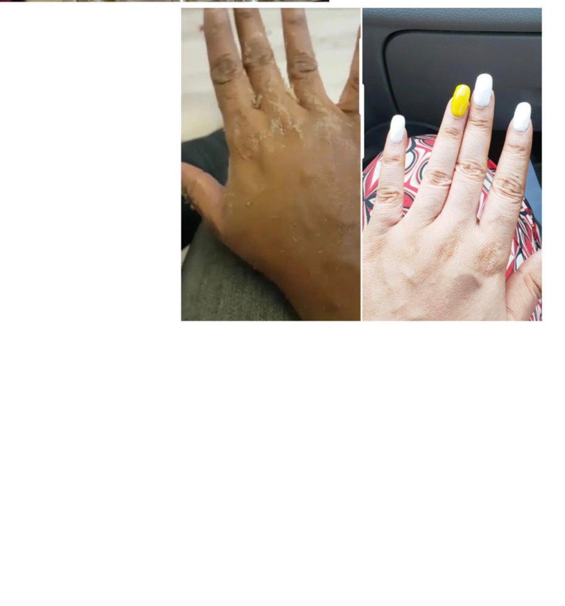 Huile de miracle peeling, et Crème pour les Phalanges points noirs image 4